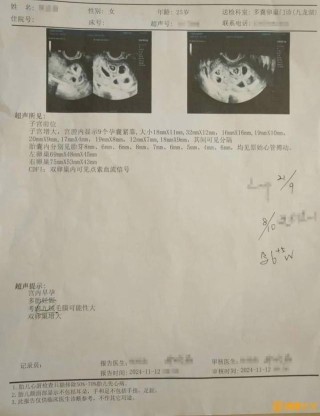 怀九胞胎女子靠输营养液保胎，其丈夫称：老婆连说话都没力气了……
