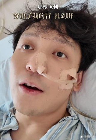 上海知名主持人百克力被鱼刺穿胃扎到肝