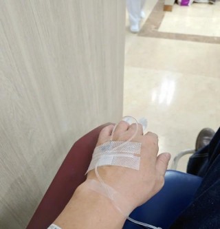 胡锡进：过去半月，老胡跑了3家医院拍了2次CT做了2次碎石看了10次医生