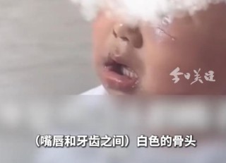 “人为撕裂”！3岁男童疑遭生父虐待，“脸肿得发亮”！警方已立案