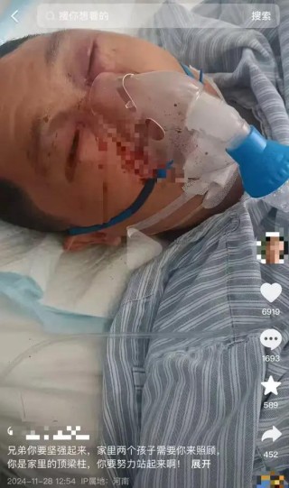杂技表演夫妻相继从高空坠下之后